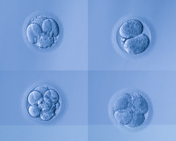 don d'ovules et d'embryons Ukraine 